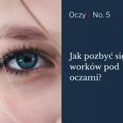 Zbliżenie na niebieskie oko z widocznymi cieniami pod oczami.