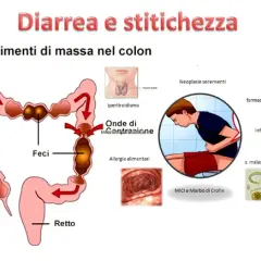Diarrea e stitichezza: cause e rimedi. Immagine mostra colon, feci, retto, ipertiroidismo, infezioni, allergie, farmaci, malassorbimento.