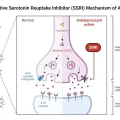 Mechanizm działania SSRI, jak Depralin. Blokada transportera serotoniny zwiększa jej dostępność w synapsie, poprawiając nastrój.