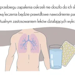 Zapalenie oskrzeli u niemowlaka: objawy, leczenie i kiedy do lekarza