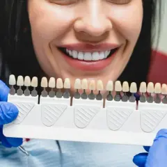 Uśmiechnięta kobieta z idealnymi zębami, dentysta pokazuje paletę kolorów do wyboru najtańszych licówek na zęby.