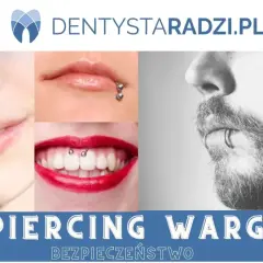 Kolczyk Smiley: Uśmiechnięty sekret wędzidełka. Czy jest bezpieczny?