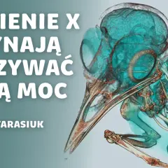 Kto wynalazł promienie X i jak zmieniły medycynę na zawsze?