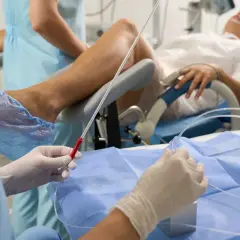 Person w rękawiczkach przygotowuje cewnik do cewnikowania pęcherza moczowego pacjentki leżącej na fotelu ginekologicznym.
