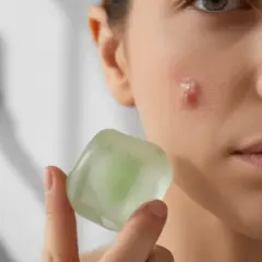 Jak zmniejszyć pryszcza? Szybkie i bezpieczne metody SOS