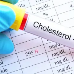 Jak czytać wyniki cholesterolu i unikać zdrowotnych zagrożeń