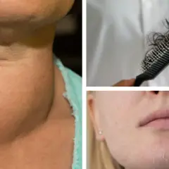 Brak jodu objawy: Jak niedobór jodu wpływa na Twoje zdrowie?