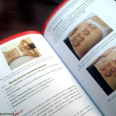 Książka omawia techniki stawiania baniek na plecach, ilustrując je na przykładach.