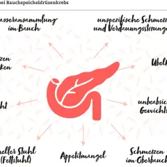 Symptome bei Bauchspeicheldrüsenkrebs: Wasseransammlung im Bauch, Rückenschmerzen, Gelbsucht, heller Stuhl, Appetitmangel, Oberbauchschmerzen, Übelkeit, unbeabsichtigter Gewichtsverlust.