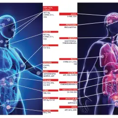 Schemat pokazuje lokalizację różnych markerów nowotworowych w ludzkim ciele, pomagając w diagnostyce.