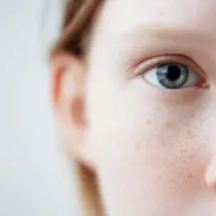 Nahaufnahme eines blauen Auges und der Wange einer Person mit Sommersprossen. Sanfte Pflege für empfindliche Haut ist hier sichtbar.