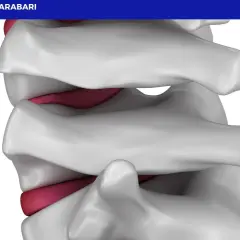 Dettaglio anatomico della colonna vertebrale, con dischi intervertebrali rossi tra le vertebre bianche. Illustra la potenziale area di interesse per la lordosi cura.