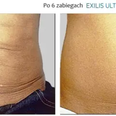 Jak pozbyć się brzucha po porodzie: 8 skutecznych metod