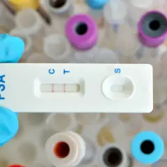 Rękawiczka trzyma test PSA, który wskazuje wynik. W tle widać probówki, co sugeruje badanie psa i przygotowanie do analizy.