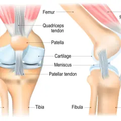 Anatomische Darstellung des menschlichen Knies mit Knochen (Femur, Tibia, Fibula), Muskeln (Quadrizeps femoris), Sehnen (Quadrizepssehne, Patellasehne) und Knorpel (Meniskus, Knorpel).