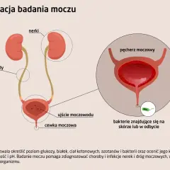 Schemat układu moczowego z zaznaczonym pęcherzem moczowym. Obok widok bakterii.