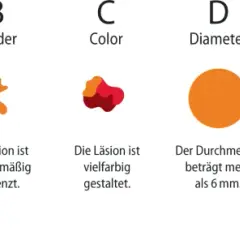 Die entscheidenden Schritte zur effektiven Melanom-Diagnostik verstehen