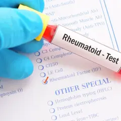 Rękawiczka w niebieskiej rękawiczce trzyma probówkę z napisem "Rheumatoid - Test". Zaznaczono "Rheumatoid Factor (RF)", co sugeruje, że to badanie na obecność czynnika reumatoidalnego.