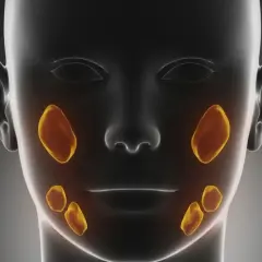 Anatomia twarzy z zaznaczonymi śliniankami. Widoczne są gruczoły przyuszne nad żuchwą i podżuchwowe pod nią.