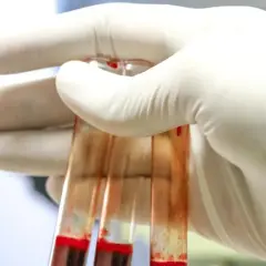 Ręka w białej rękawiczce trzyma probówki z krwią. TPO - klucz do analizy.