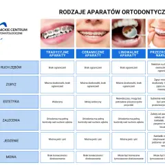 Aparat ortodontyczny: Rodzaje, ceny jak wybrać idealny?