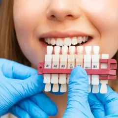 Uśmiechnięta kobieta z paletą odcieni zębów. Dentysta w niebieskich rękawiczkach dobiera kolor do wybielania zębów.
