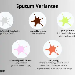 Gelb, grünlich: Eiter bei bakterieller Infektion, Virus, Mukoviszidose. Das Bild zeigt verschiedene Sputum-Varianten.