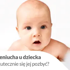 Urocze niemowlę z zaciekawioną miną. Tekst informuje o ciemieniuchy u dziecka i sposobach jej usuwania.