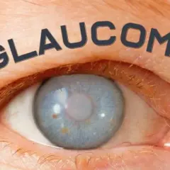 Síntomas de glaucoma: cómo reconocer señales de alerta y evitar la ceguera