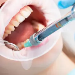 Ile godzin trzyma znieczulenie u dentysty? Co musisz wiedzieć, aby uniknąć bólu