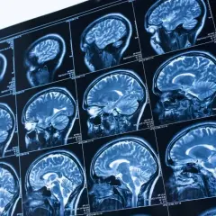 Sekwencja przekrojów głowy w badaniu rezonans magnetyczny głowy z kontrastem, ukazująca szczegóły mózgu.