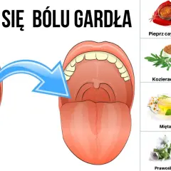 Jak zapobiec anginie - najskuteczniejsze sposoby na zdrowe gardło.