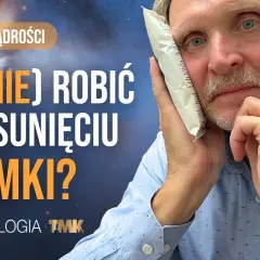 Koszt zdjęcia szwów z dziąsła: 50-150 zł? Czy zawsze płacisz?