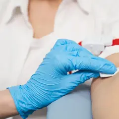 Ręka w niebieskiej rękawiczce dezynfekuje skórę przed pobraniem krwi.