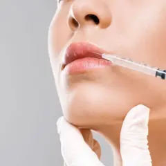 Dalle mani di un'estetista a quelle di un medico estetico: un primo piano di labbra che ricevono un trattamento di filler con siringa.