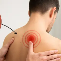 Illustration d'un muscle avec un point rouge indiquant un trigger point psoas, flèche pointant vers une zone douloureuse sur l'épaule d'un homme.