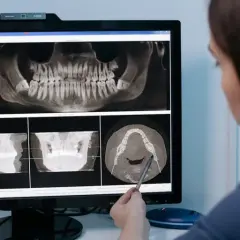 Czy dentysta widzi że ktoś pali? Objawy palenia, które zaskakują