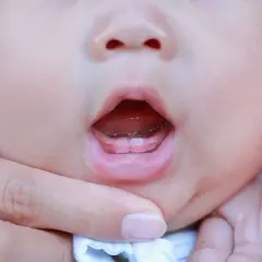 Le prime gemme dei denti dei bambini spuntano, un piccolo sorriso che promette tante scoperte.