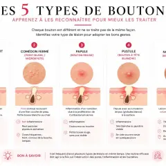Infographie expliquant les 5 types de bouton : comédon, papule, pustule, nodule/kyste. Chaque bouton de brulure est illustré et décrit.