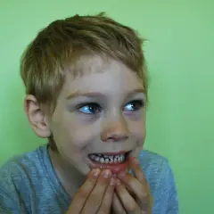 Bambino con denti sensibili, cerca un rimedio immediato.