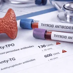 Model tarczycy, probówki z "THYROID ANTIBODIES" i wyniki badań, wskazujące na podwyższone poziomy anty-TPO i anty-TG.