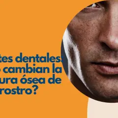 Primer plano de un rostro masculino con texto que pregunta cómo los implantes dentales cambian la estructura ósea.