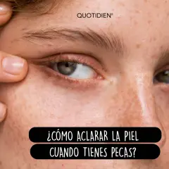 Primer plano de un ojo y mejilla con pecas. Un dedo tira suavemente de la piel del párpado inferior. Texto: "¿Cómo aclarar la piel cuando tienes pecas?".