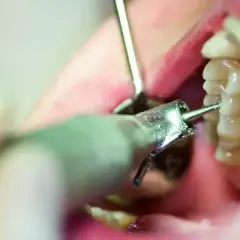 Czy dentysta może odmówić przyjęcia pacjenta z bólem zęba? Oto prawda