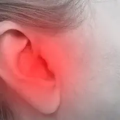 Czerwony rumień na uchu, obejmujący helix, sugeruje ból lub stan zapalny.