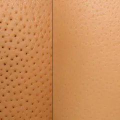 Skóra przed i po zabiegu. Po lewej widoczne zaskórniki, po prawej gładka cera. Peeling kawitacyjny - efekty uboczne mogą być różne, ale ten zabieg działa cuda!