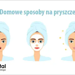 Co jest dobre na pryszcze? Sprawdzone metody i porady eksperta