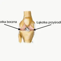 Anatomia kolana z zaznaczoną łąkotką boczną i przyśrodkową.