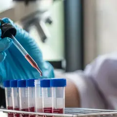 Ręka w niebieskiej rękawiczce pobiera próbkę krwi do analizy. Badanie HIV cena jest kluczowa dla szybkiej diagnostyki.
