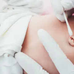 Delikatne czyszczenie pępka noworodka. Kiedyś to był pępowina, teraz to pamiątka po życiu w brzuchu mamy.
